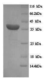 SDS-PAGE