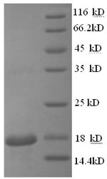 SDS-PAGE