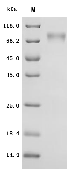 SDS-PAGE