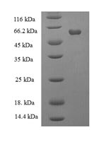 SDS-PAGE