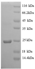 SDS-PAGE