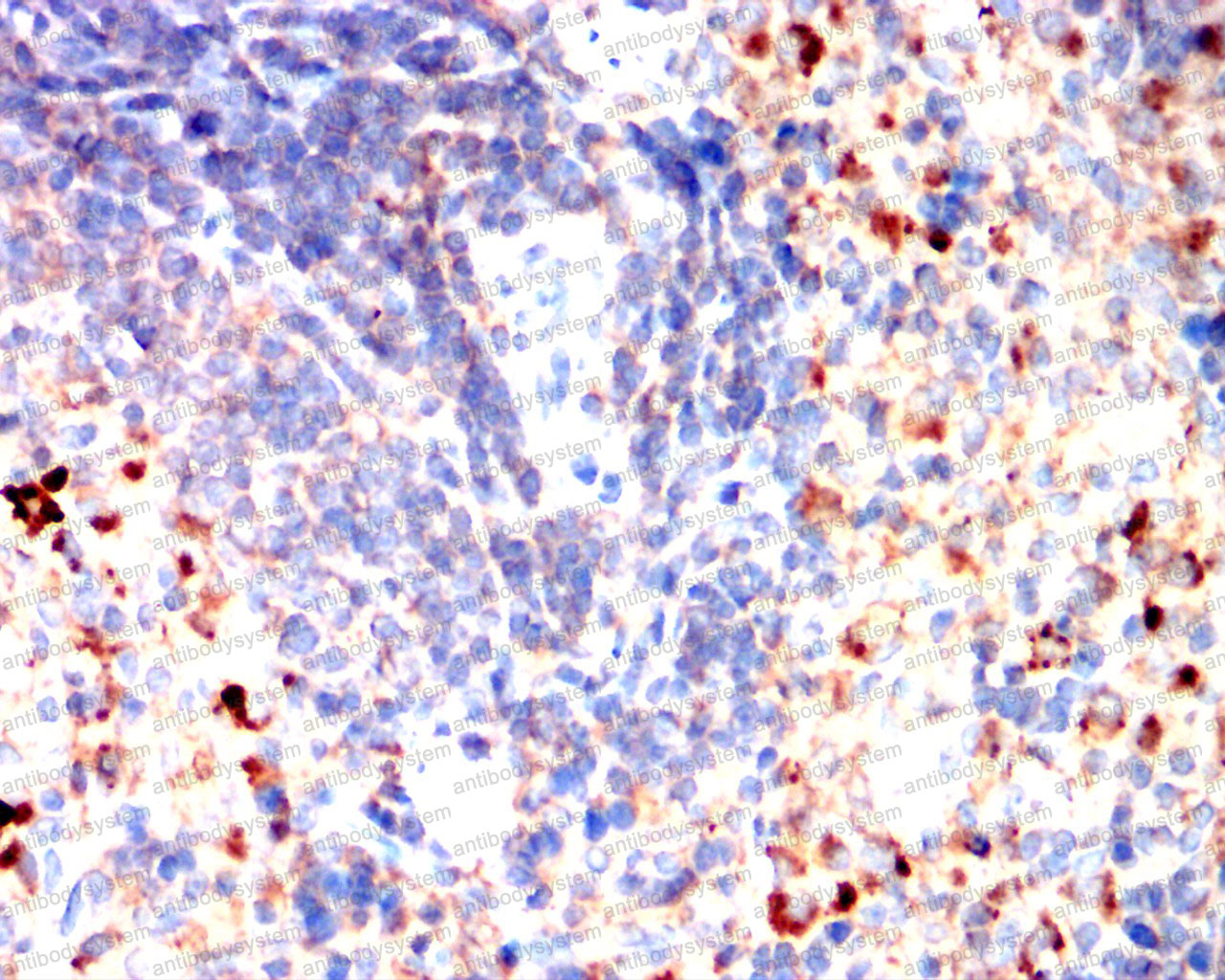 Валидация AntibodySystem RHE35201 (2101)