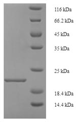 SDS-PAGE