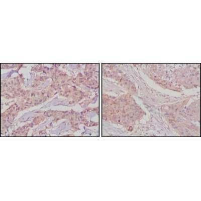 Валидация Affinity BF0695 - 5369