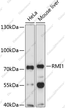 Вестерн-блоттинг, RMI1, различные клеточные линии