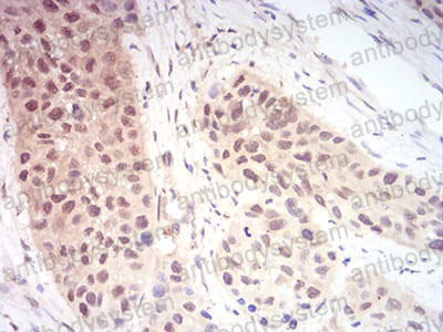 Валидация AntibodySystem RHF53502 (2562)