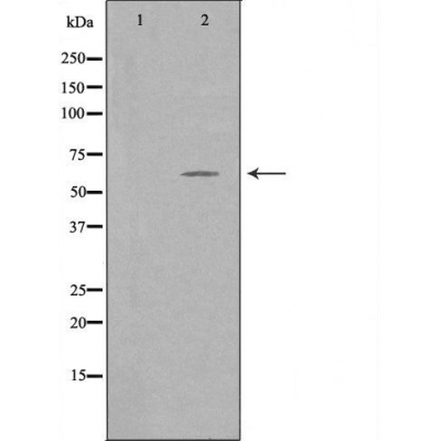 Валидация Affinity DF3114 - 13881
