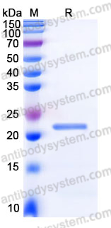 EHJ46401, SDS-PAGE