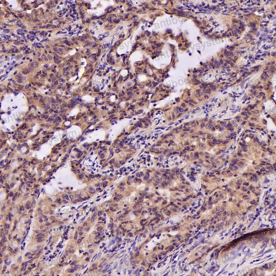 Валидация AntibodySystem RHN60301 (3838)