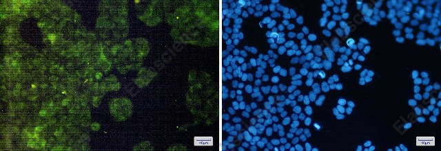 Иммунофлуоресценция, AdSS 2, клетки HeLa