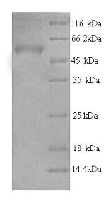 SDS-PAGE