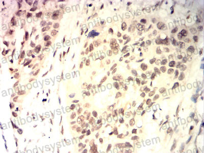 Валидация AntibodySystem RHD31503 (1474)