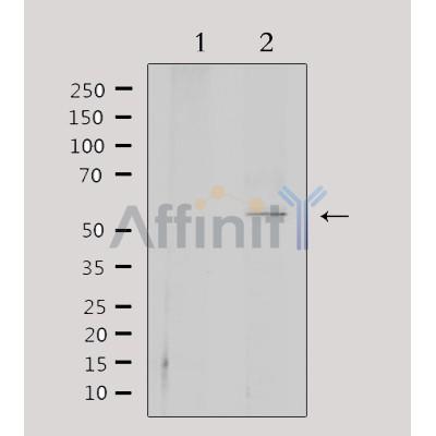 Валидация Affinity DF3918 - 15098