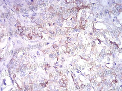 Валидация AntibodySystem RHF12002