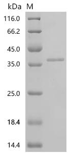 SDS-PAGE