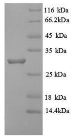 SDS-PAGE