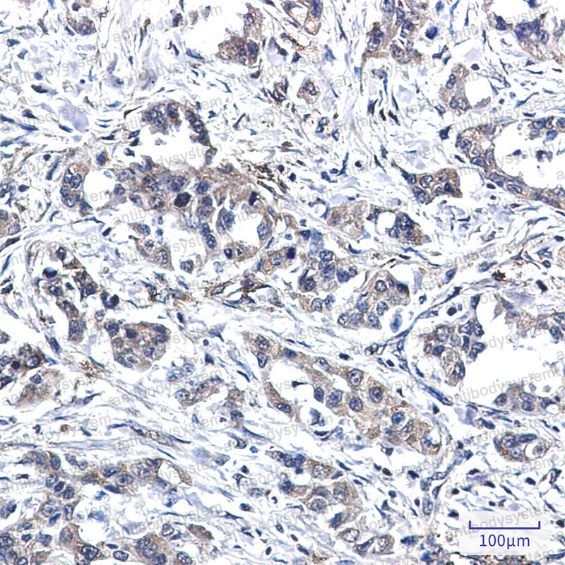 Валидация AntibodySystem RHE05603