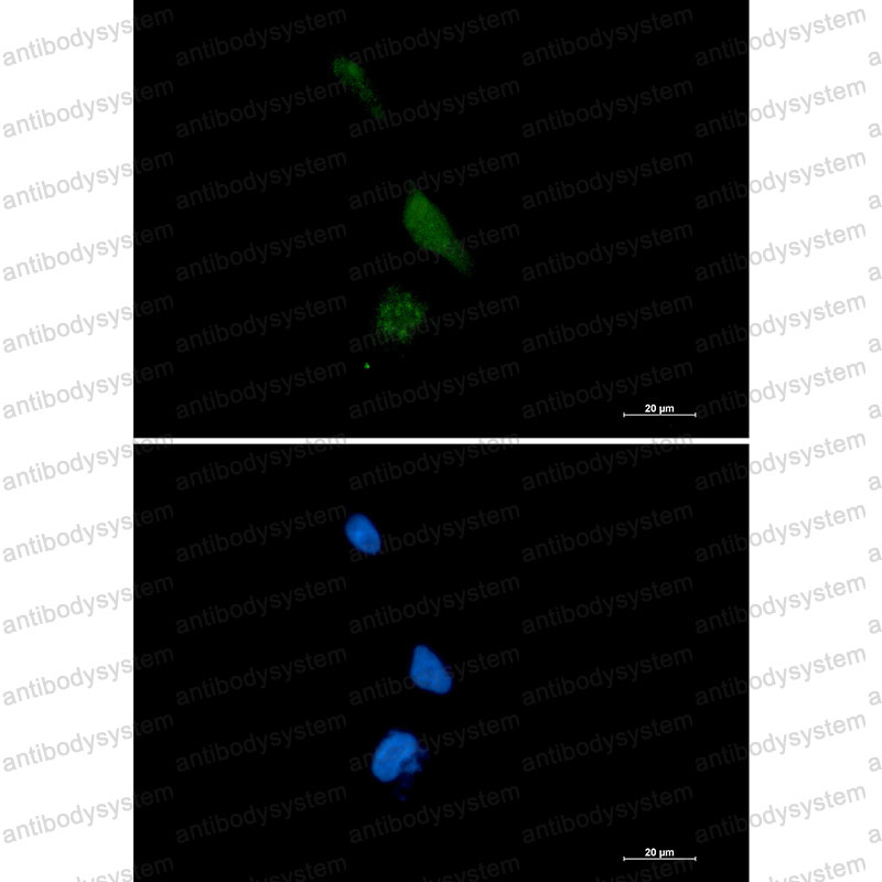 Валидация IF - AntibodySystem RHH79201