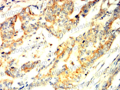 Валидация AntibodySystem RHD40501