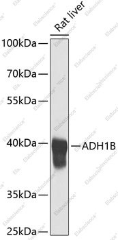 Вестерн-блоттинг, ADH1B, ткань печени крысы