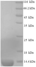 SDS-PAGE