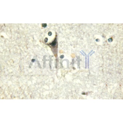 Валидация Affinity AF6405 - 3697