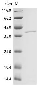 SDS-PAGE