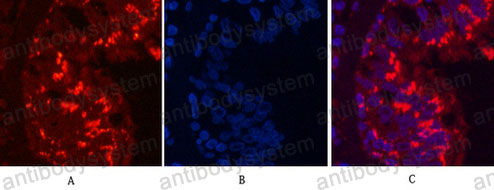 Валидация IF - AntibodySystem RHE04901 (765)