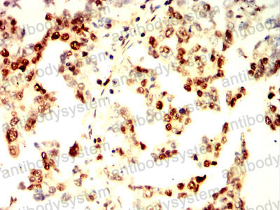 Валидация AntibodySystem RHF04701 (2444)