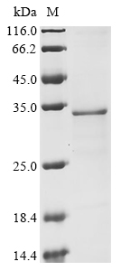 SDS-PAGE