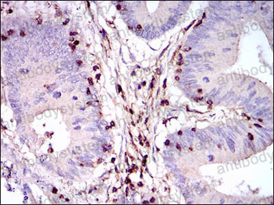 Валидация AntibodySystem RHC34004