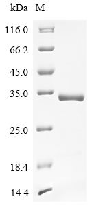 SDS-PAGE