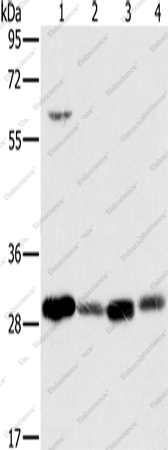 Вестерн-блоттинг, MRPL28, клетки 293T, ткань яичка человека, клетки A375, ткань почки человека
