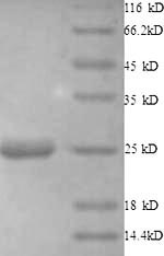 SDS-PAGE