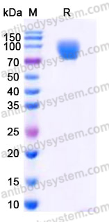 AHD89502, SDS-PAGE