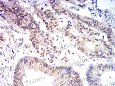 Валидация AntibodySystem RHB58803