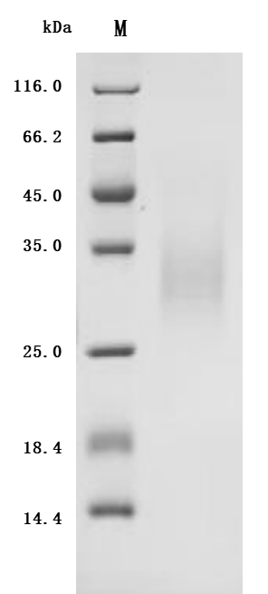 SDS-PAGE