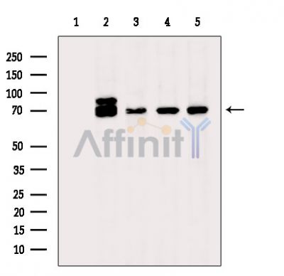 Валидация Affinity DF15250 - 11527