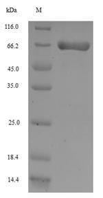 SDS-PAGE