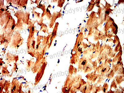 Валидация AntibodySystem RHE44903