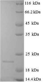 SDS-PAGE