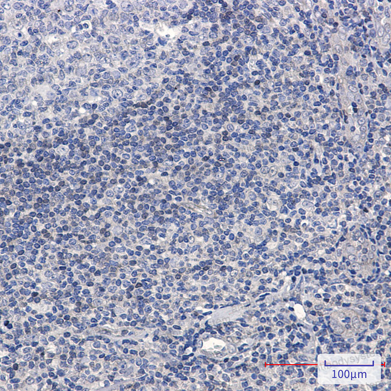 Валидация AntibodySystem RHF11301