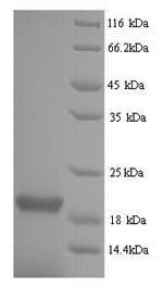 SDS-PAGE