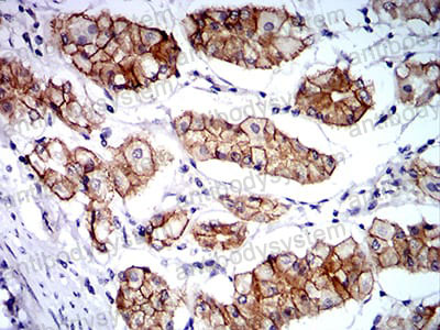 Валидация AntibodySystem RHE07502