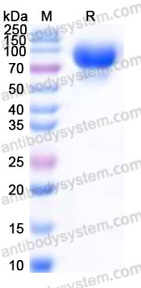EWD89501, SDS-PAGE