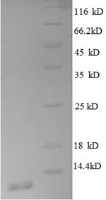 SDS-PAGE