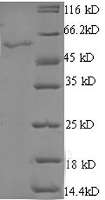 SDS-PAGE