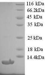 SDS-PAGE