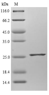 SDS-PAGE