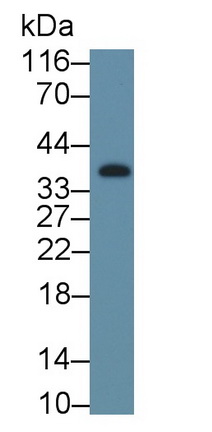38723